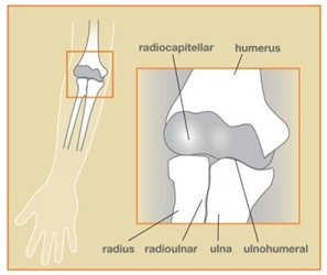 ulna elbow fracture