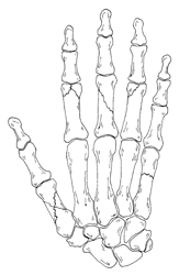 Image related to Hand Fractures | Hand Surgery Houston TX